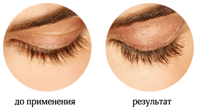 средство для роста ресниц карепрост